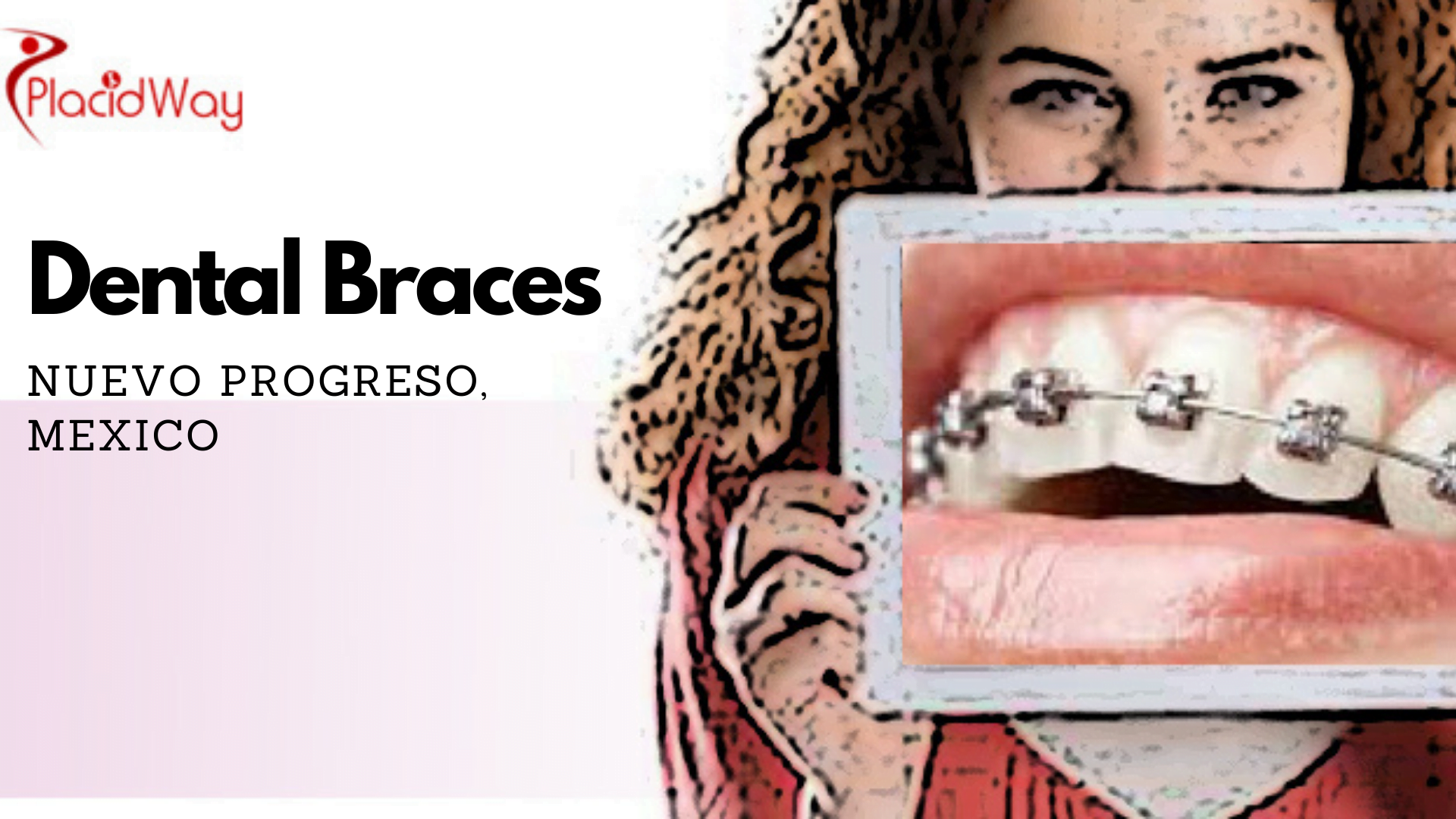 Top Dental Braces in Nuevo Progreso, Mexico Mexico Border Dentist