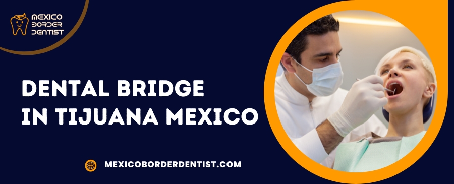 Dental Bridge in Tijuana Mexico