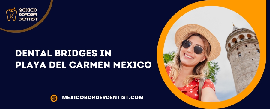 Dental Bridges in Playa Del Carmen Mexico