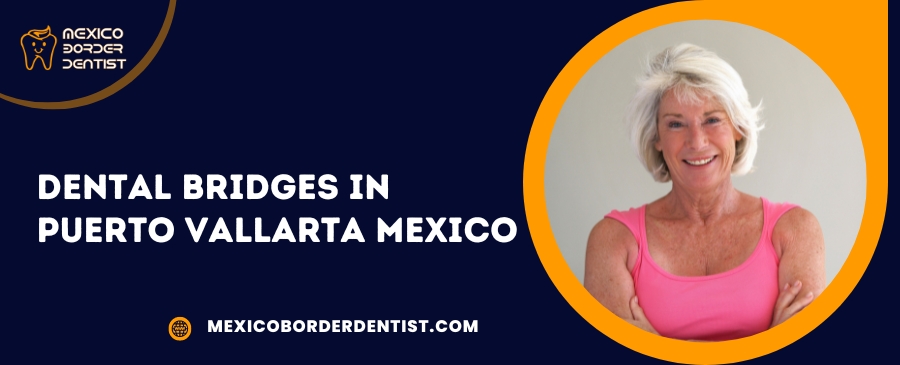 Dental Bridges in Puerto Vallarta Mexico