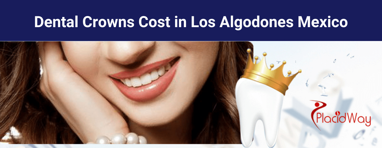 Dental Crowns Cost in Los Algodones Mexico
