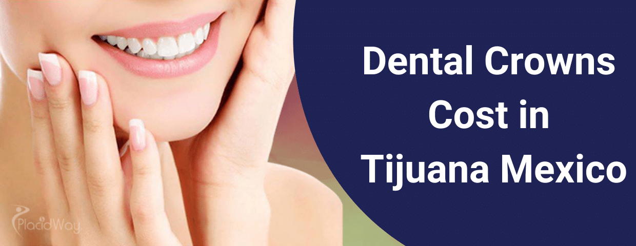 Dental Crowns Cost in Tijuana Mexico