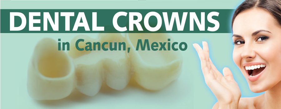 Dental Crowns Cancun Mexico