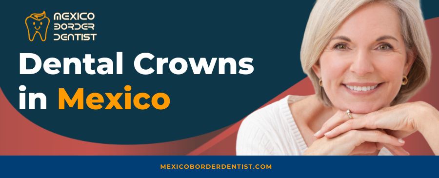 Dental Crowns in Mexico