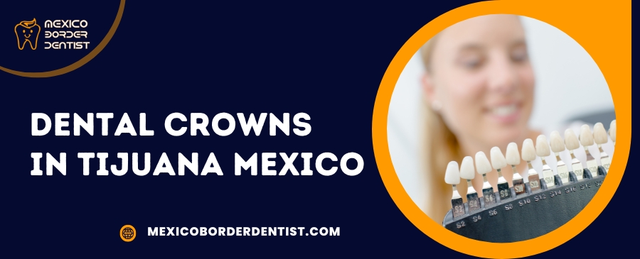 Dental Crowns in Tijuana Mexico