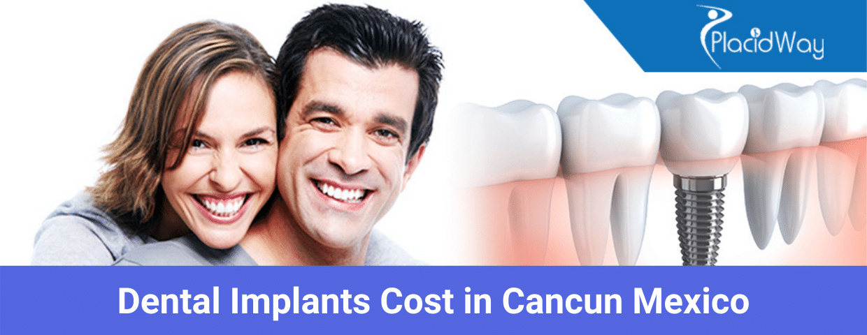 Dental Implants Cost in Cancun Mexico