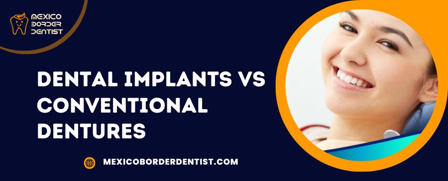 Dental Implants VS Conventional Dentures