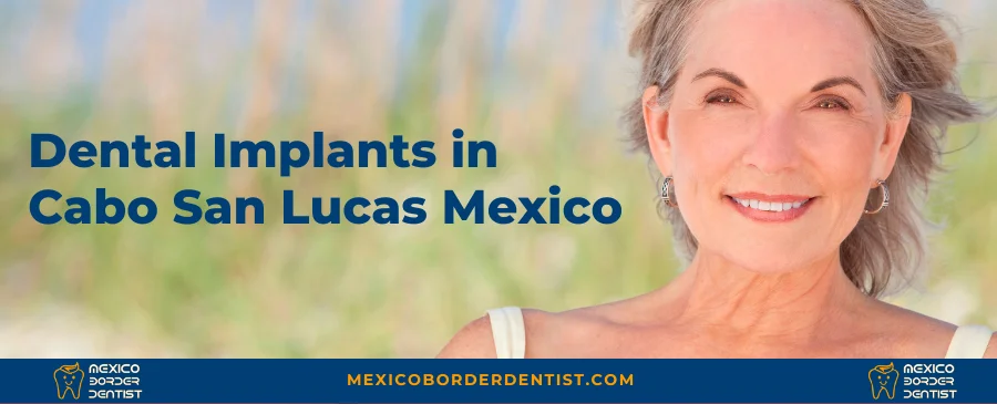 Dental Implants in Cabo San Lucas Mexico