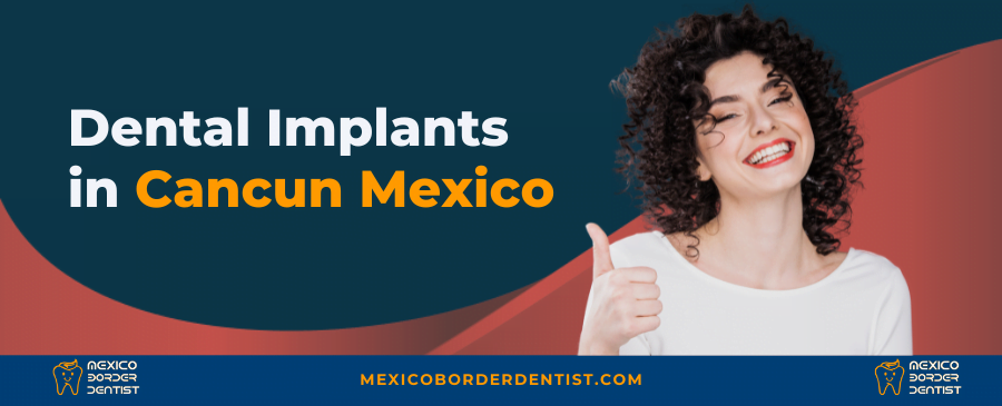 Dental Implants in Cancun Mexico