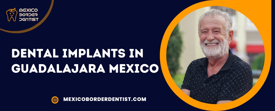 Dental Implants in Guadalajara Mexico