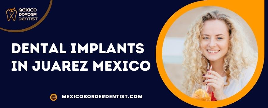 Dental Implants in Juarez Mexico