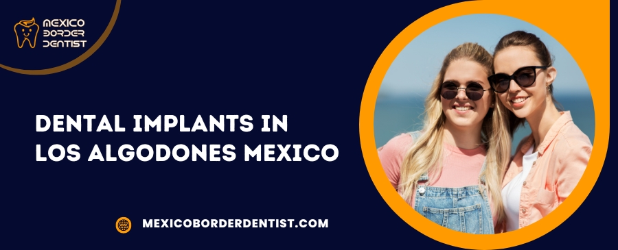 Dental Implants in Los Algodones Mexico