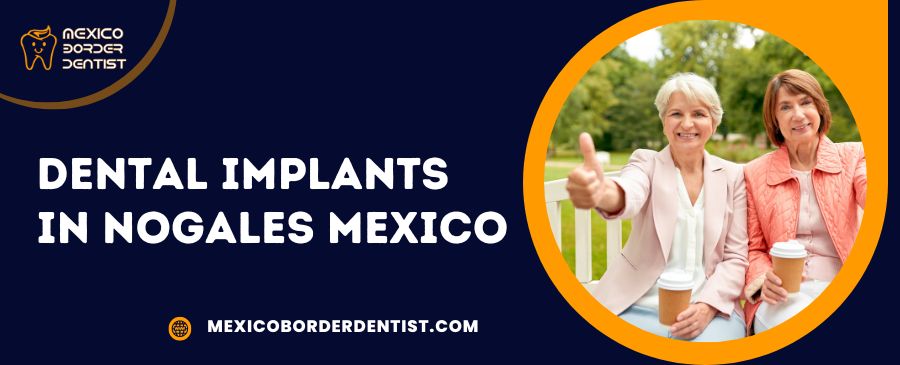 Dental-Implants-in-Nogales-Mexico