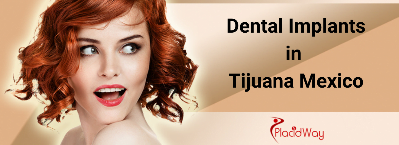 Dental implants in tijuana Mexico