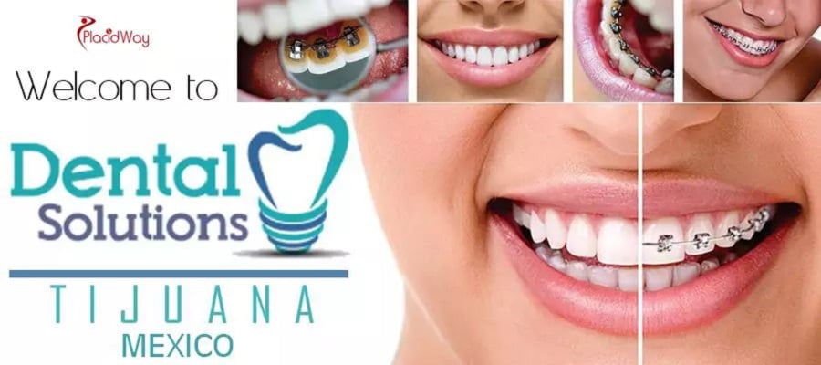 Dental Solutions Tijuana – Best Dental Surgery in Tijuana Mexico 1