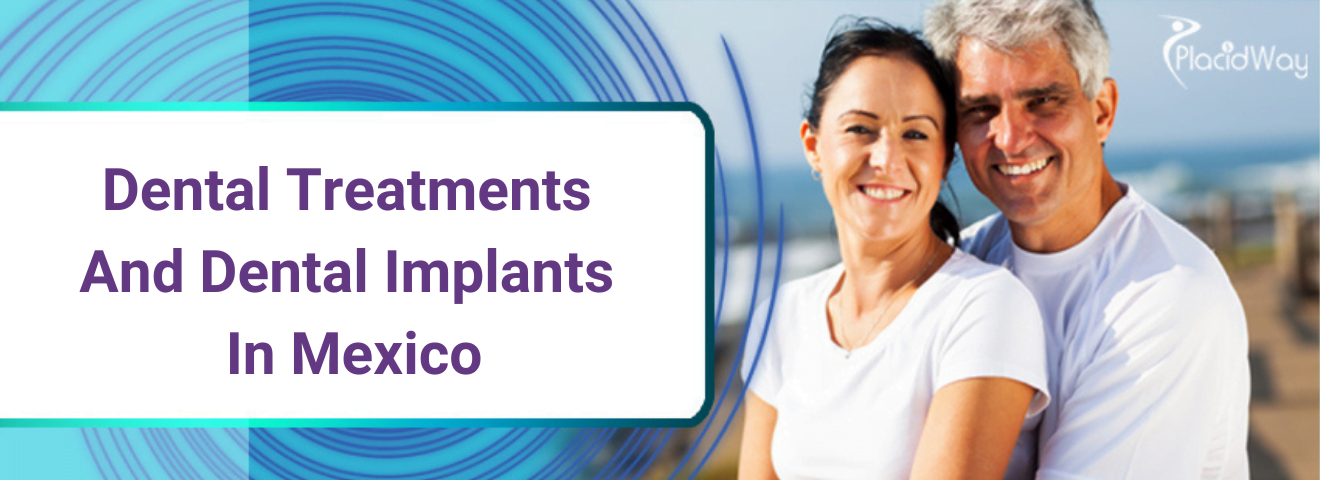 Dental Treatments in Mexico | Dental Implants Information Guide