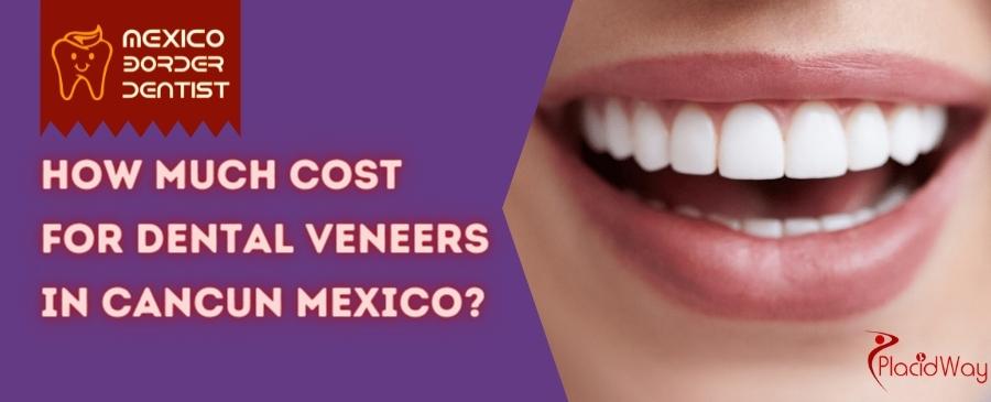 Dental Veneers Cost in Cancun Mexico