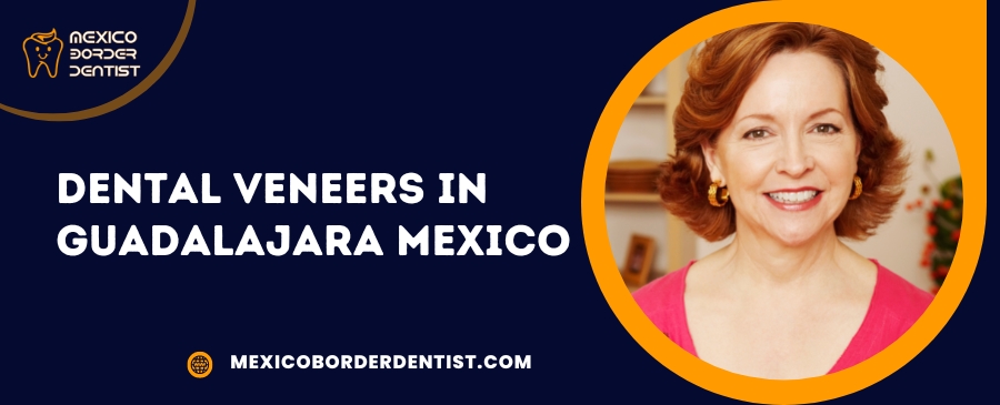 Dental Veneers in Guadalajara Mexico
