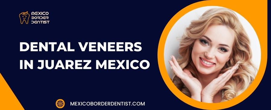 Dental Veneers in Juarez Mexico