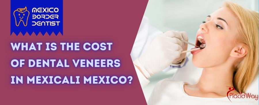 Dental Veneers in Mexicali Mexico