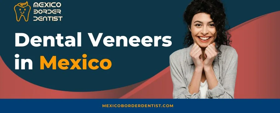 Dental Veneers in Mexico