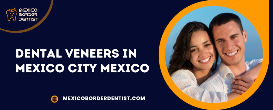 Dental Veneers in Mexico City Mexico