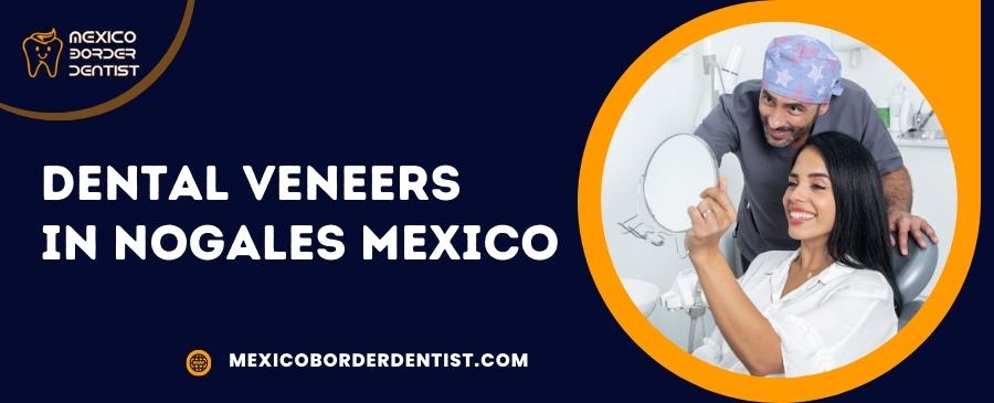 Dental Veneers in Nogales Mexico