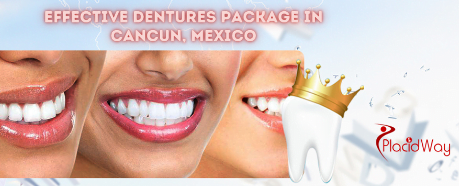 Dentures Package in Cancun Mexico