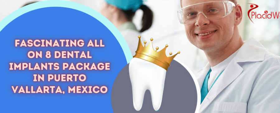 Fascinating All on 8 Dental Implants Package in Puerto Vallarta, Mexico