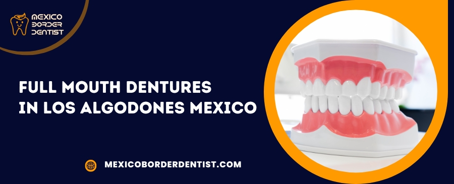 Full Mouth Dentures in Los Algodones Mexico