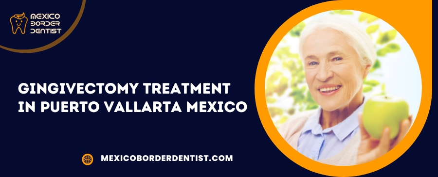 Gingivectomy Treatment in Puerto Vallarta Mexico
