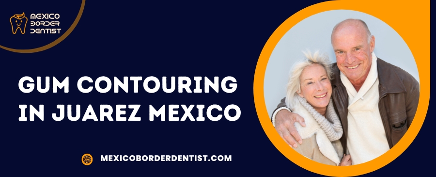 Gum Contouring in Juarez Mexico
