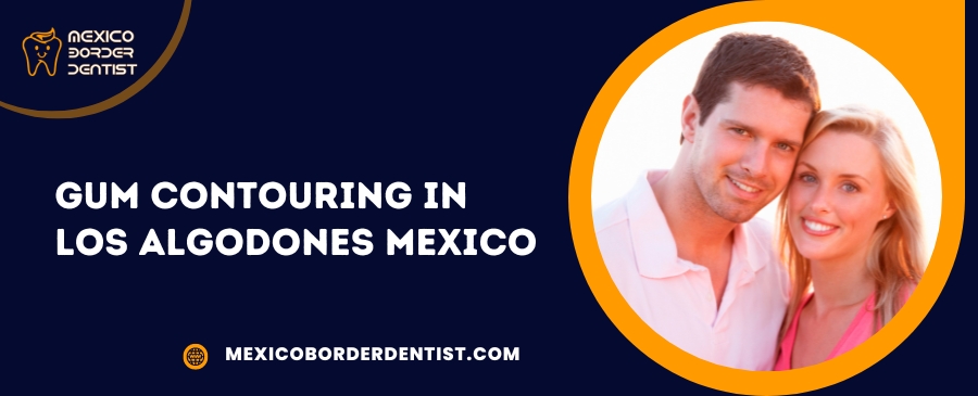 Gum Contouring in Los Algodones Mexico
