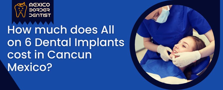 How much does All on 6 Dental Implants cost in Cancun Mexico?