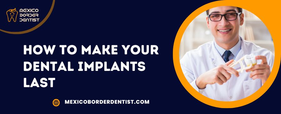 How to Make your Dental Implants Last