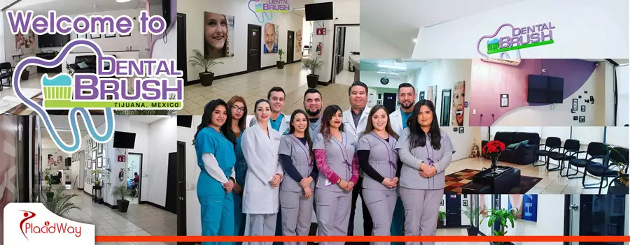 Dental Brush - Best Cosmetic Dentist in Tijuana Mexico