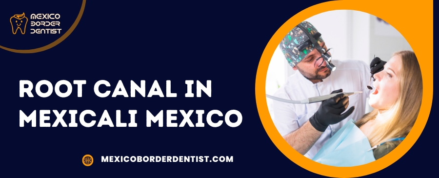 Root Canal Treatment in Mexicali Mexico