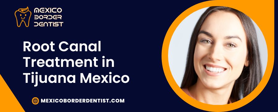 Root Canal Treatment in Tijuana Mexico