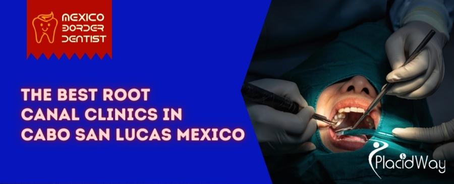 Root Canal in Cabo San Lucas