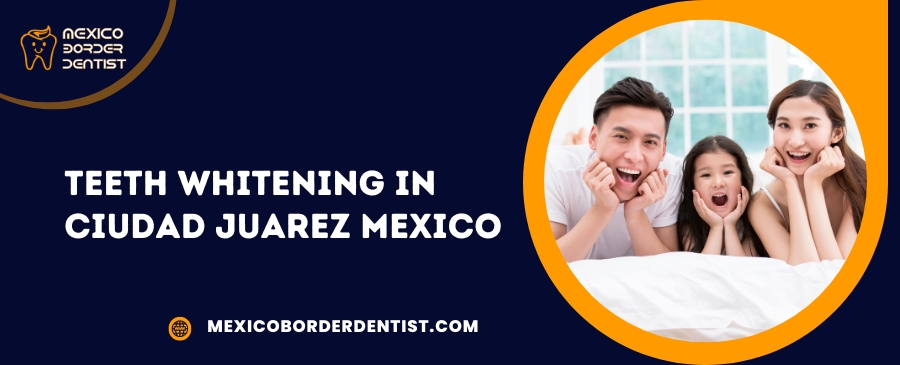 Teeth Whitening in Ciudad Juarez Mexico