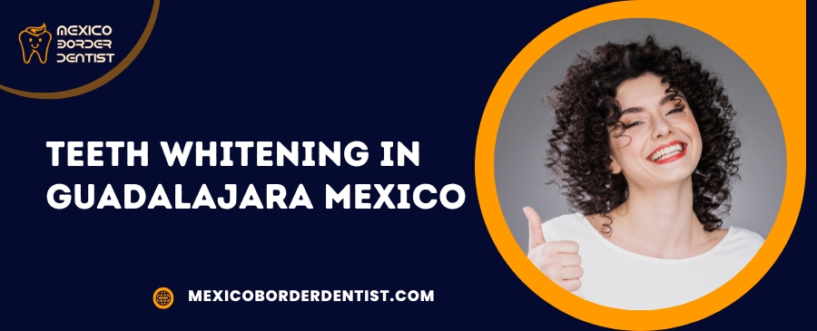 Teeth Whitening in Guadalajara Mexico