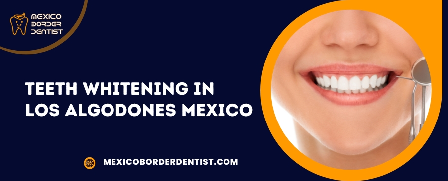 Teeth Whitening in Los Algodones Mexico
