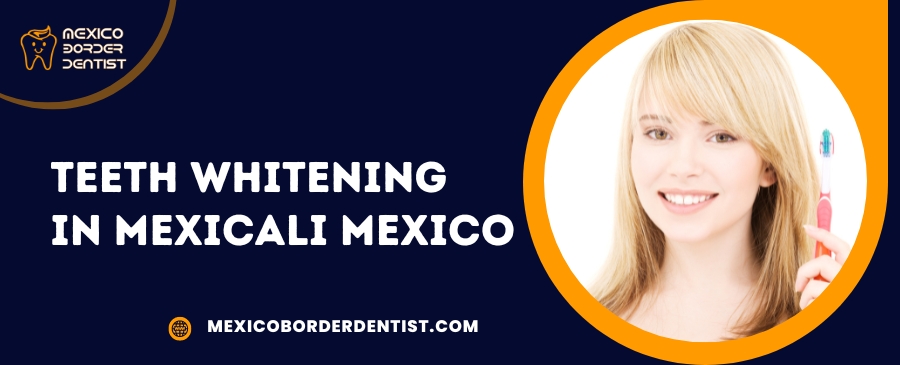 Teeth Whitening in Mexicali Mexico