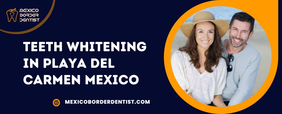 Teeth Whitening in Playa Del Carmen Mexico
