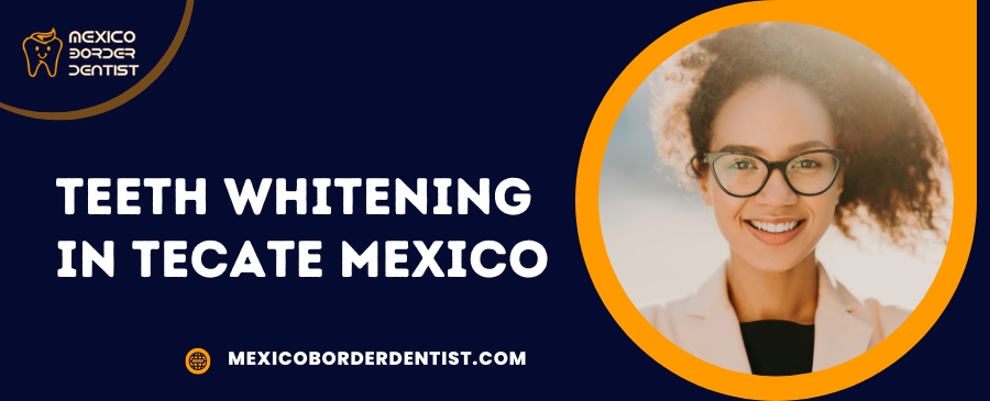 Teeth Whitening in Tecate Mexico