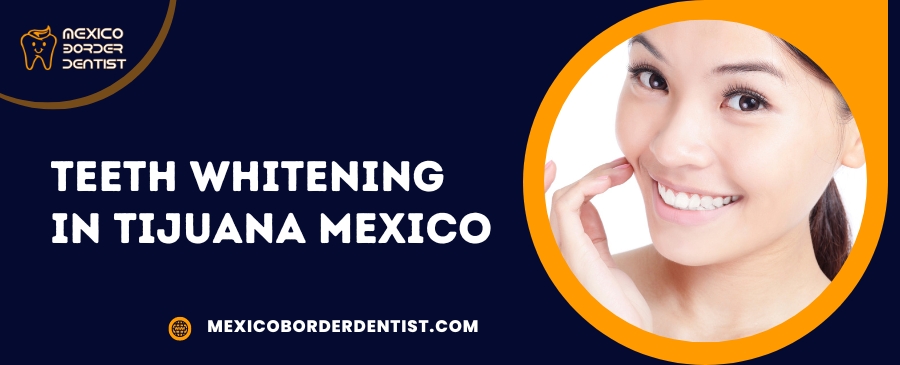 Teeth Whitening in Tijuana Mexico