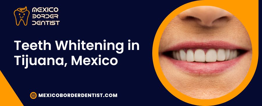 Teeth Whitening in Tijuana, Mexico