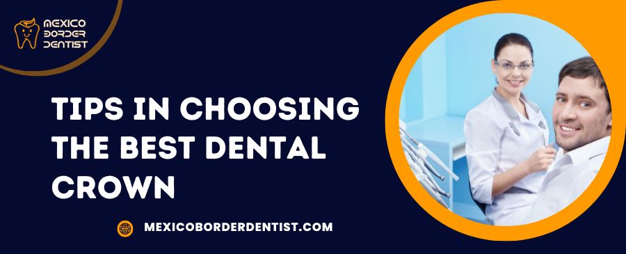Tips in Choosing the Best Dental Crown