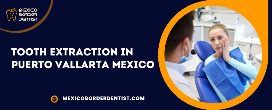 Tooth Extraction in Puerto Vallarta Mexico
