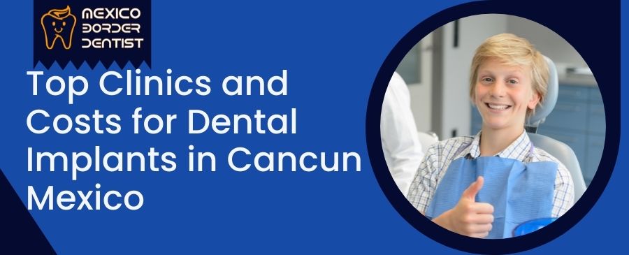 Top Clinics and Costs for Dental Implants in Cancun Mexico